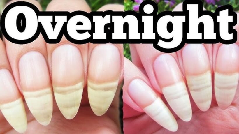 How to Make Your Nails Grow Overnight: Proven Tips for Faster Growth